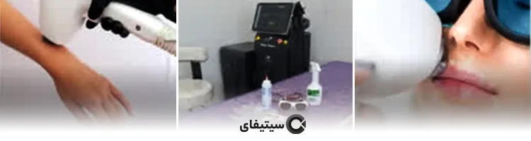 ستین